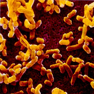 Black plague
                        bacterium Yersinia pestis (formerly called:
                        pasteurella pestis)