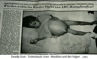 Bericht von Dr. Gnther ber die Kinder
                von Basra 1991 01