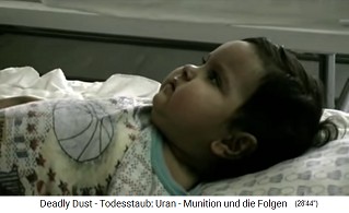 Child with radioactive NATO damage
                                from nuclear missile ("uranium
                                ammunition") 02