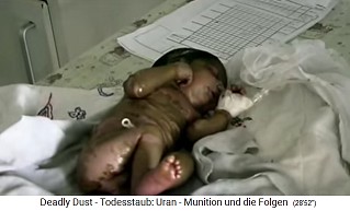 Child with NATO damage by nuclear missile
                          ("uranium ammunition") 3