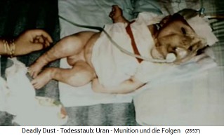 Child with radioactive NATO damage
                                from nuclear missile ("uranium
                                ammunition") 04