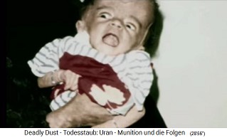 Child with radioactive NATO damage
                                from nuclear missile ("uranium
                                ammunition") 05