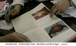 Basra, Mutter-Kind-Krankenhaus",
                              Buch mit Babyfotos mit Geburtsfehlern 03