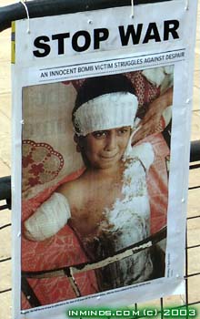 Bombenopfer im Irak: Bub ohne Arme / Bomb
                      victim in Iraq: Boy without arms