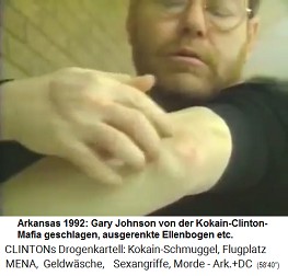 Arkansas 1992:
                                      Gary Johnson von der
                                      Kokain-Clinton-Mafia geschlagen,
                                      ausgerenkte Ellenbogen