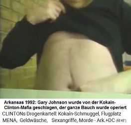 Arkansas 1992: Gary Johnson von
                                  der Kokain-Clinton-Mafia geschlagen,
                                  der ganze Bauch wurde operiert