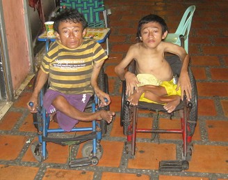 Agent-Orange-Opfer 1+2, zwei Brüder mit plattenförmigen Armknochen und Beinknochen in Rollstühlen 01, Nahaufnahme