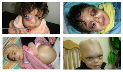 News about
                                  criminal radioactive NATO: in Iraq are
                                  living thousands of deformed children
                                  by radioactive NATO uranium
                                  ammunition