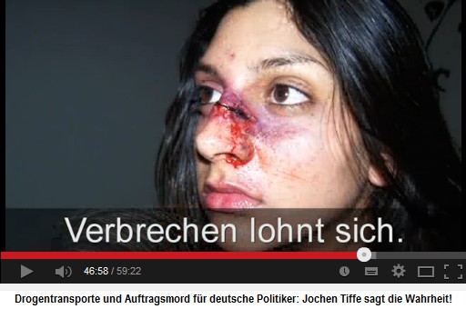 Eine Frau mit einem genähten
                            Nasenbeinbruch - die muslimischen und die
                            linken Schläger werden von der Kölner Justiz
                            nie bestraft