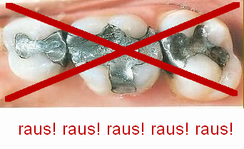 Amalgam ist
                        Sondermll und muss sofort alles raus!