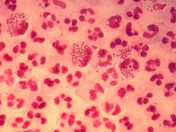 Microbios (aqu:
                        neisseria gonorrhoeae) pueden imitar antgenos y
                        por eso pueden trucar el sistema inmunolgico
                        cuando la alimentacin no corresponde con el
                        grupo sanguneo.