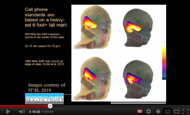 Ein
                  Handy am Hirn verstrahlt einen Teil des Hirns