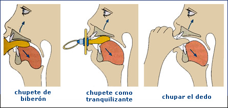 Malformacin dentaria por demasiado chupar
                        a biberones (chupete de bibern), chupetes
                        (chupetes de tranquilizacin) y por chupar
                        demasiado el dedo [5]: Los primeros dientes
                        incisivos van ser levantado [8].