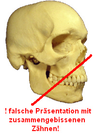 Auch das Schädelmodell des
                              anatomischen Museums Basel ist mit
                              zusammengepressten Zähnen dargestellt,
                              anatomisch völlig falsch und absolut
                              schädlich für die Zähne