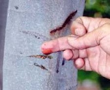 Oncolog�a: c�ncer cuara p.e. con
                              sangre de grado