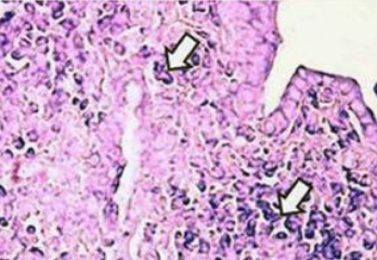 Microfotograf�a de
                            pulm�n de rata intoxicada por antracenonas
                            de una planta silvestre.