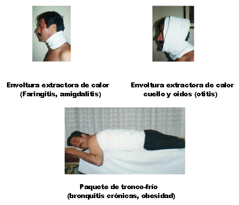Envolturas