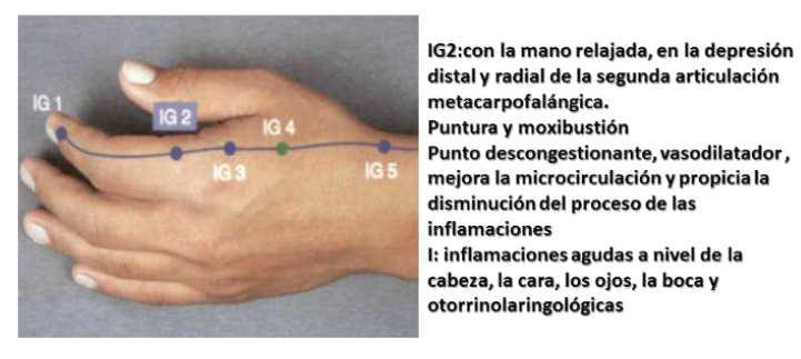 Punto de
                          dolor IG2