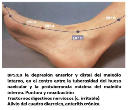 Punto BP5