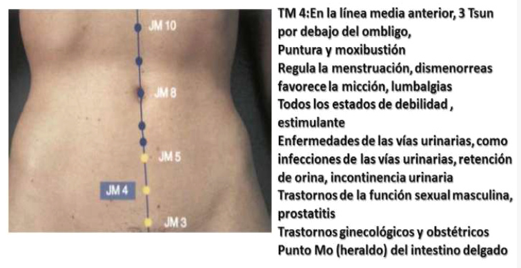Puntos Lumbagos