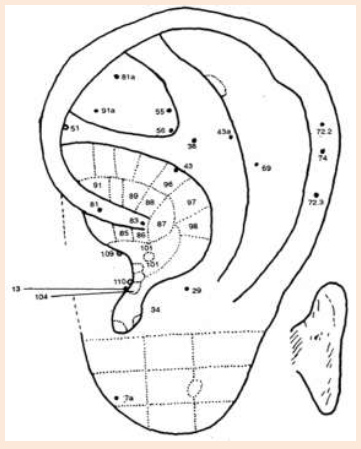Cartograma auricular, enfasis en el
                          centro