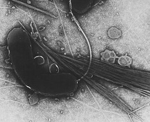 Cholera pathogen "Vibrio
                        cholerae", the popular expression was
                        "comma bacillus"